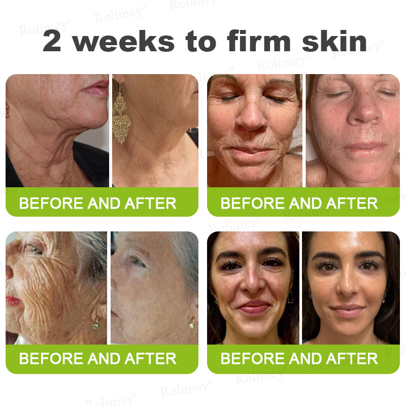 👏✨💯Made and shipped from the USA 💫Rolimey® Botox & Vita-A Retinol Shot Wrinkle-Lift Tightening cream - Last Day Promotion 70% OFF