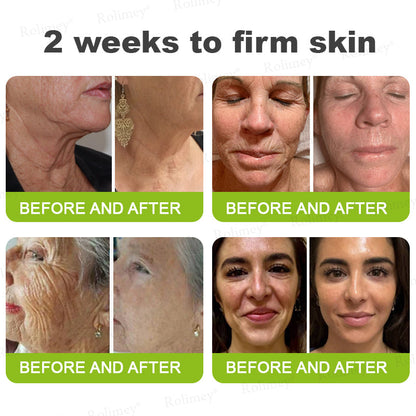 👏✨💯Made and shipped from the USA 💫Rolimey® Botox & Vita-A Retinol Shot Wrinkle-Lift Tightening cream - Last Day Promotion 70% OFF