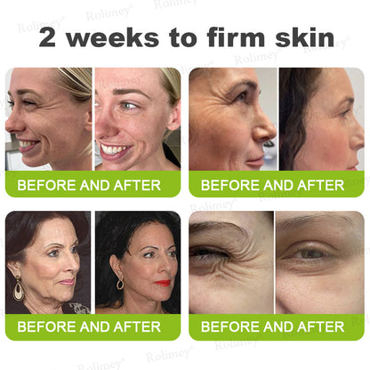 👏✨💯Made and shipped from the USA 💫Rolimey® Botox & Vita-A Retinol Shot Wrinkle-Lift Tightening cream - Last Day Promotion 70% OFF