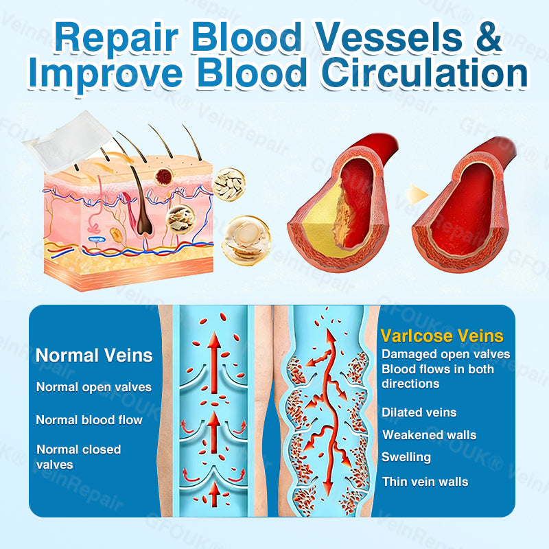 🇺🇸👨‍⚕️👨‍⚕️✅GFOUK® VeinRepair Microneedle Patch Roll⚡Instant Relief, Long-Term Results