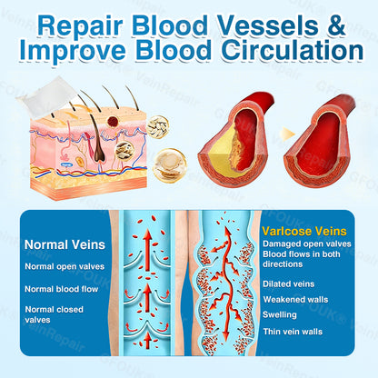 🇺🇸👨‍⚕️👨‍⚕️✅GFOUK® VeinRepair Microneedle Patch Roll⚡Instant Relief, Long-Term Results