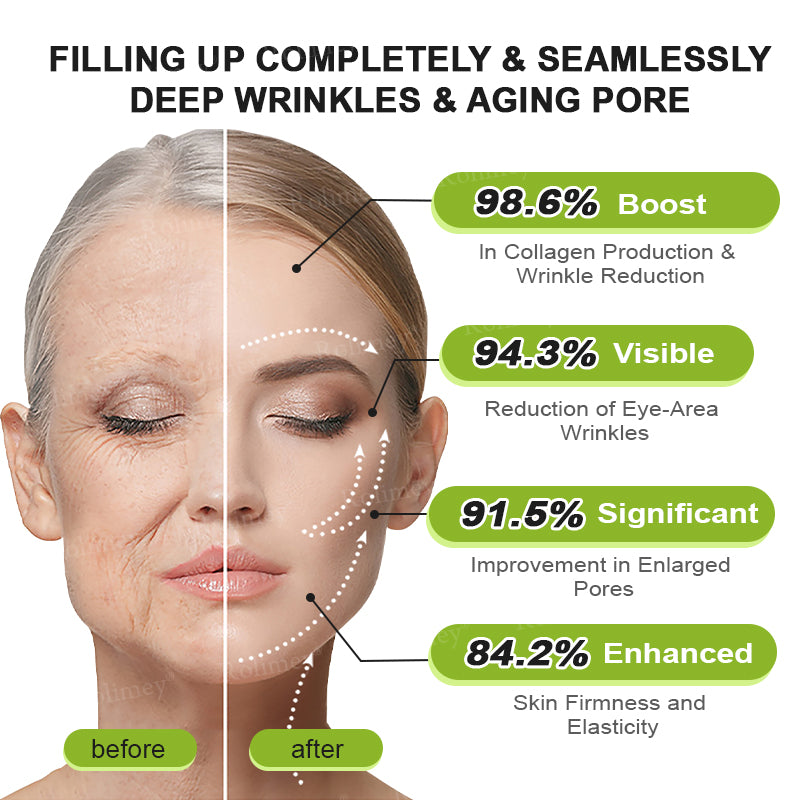👏✨💯Made and shipped from the USA 💫Rolimey® Botox & Vita-A Retinol Shot Wrinkle-Lift Tightening cream - Last Day Promotion 70% OFF