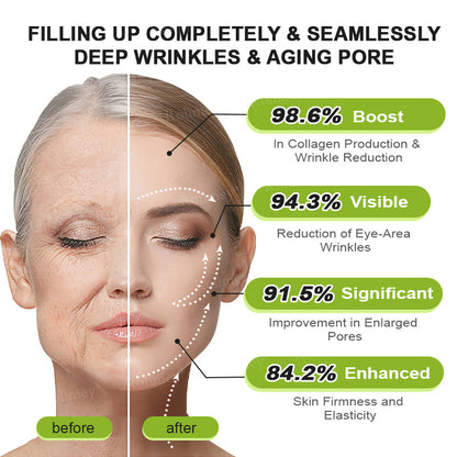 👏✨💯Made and shipped from the USA 💫Rolimey® Botox & Vita-A Retinol Shot Wrinkle-Lift Tightening cream - Last Day Promotion 70% OFF