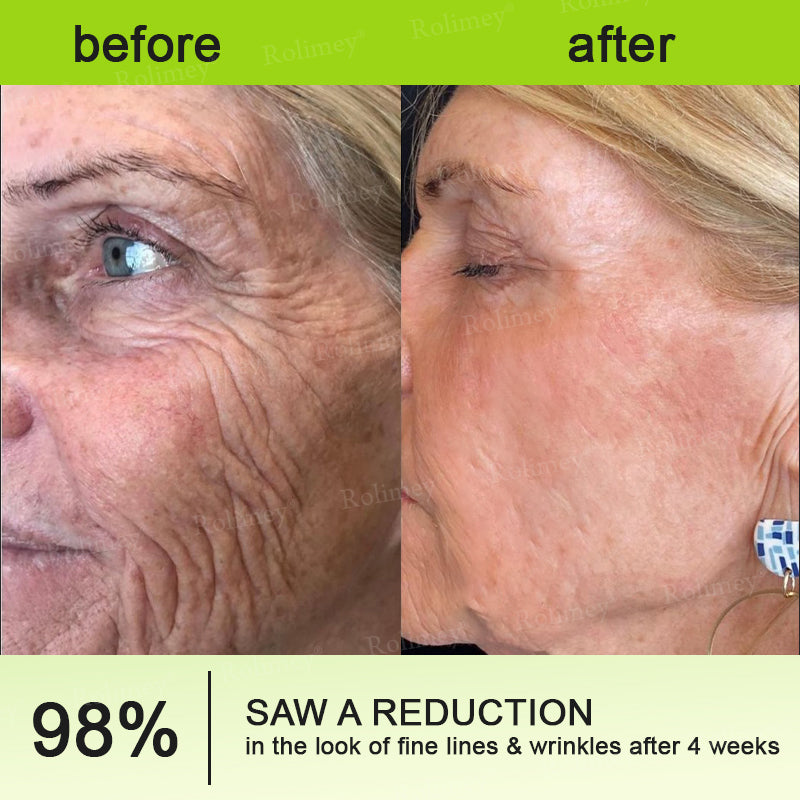 👏✨💯Made and shipped from the USA 💫Rolimey® Botox & Vita-A Retinol Shot Wrinkle-Lift Tightening cream - Last Day Promotion 70% OFF