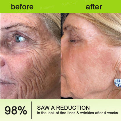 👏✨💯Made and shipped from the USA 💫Rolimey® Botox & Vita-A Retinol Shot Wrinkle-Lift Tightening cream - Last Day Promotion 70% OFF