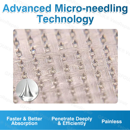 🇺🇸👨‍⚕️👨‍⚕️✅GFOUK® VeinRepair Microneedle Patch Roll⚡Instant Relief, Long-Term Results