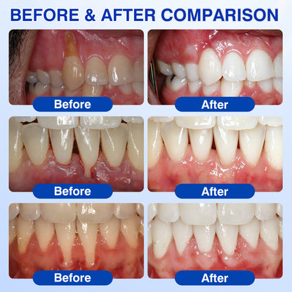 Evolvion® GumRevive Periodontal Repair Gel