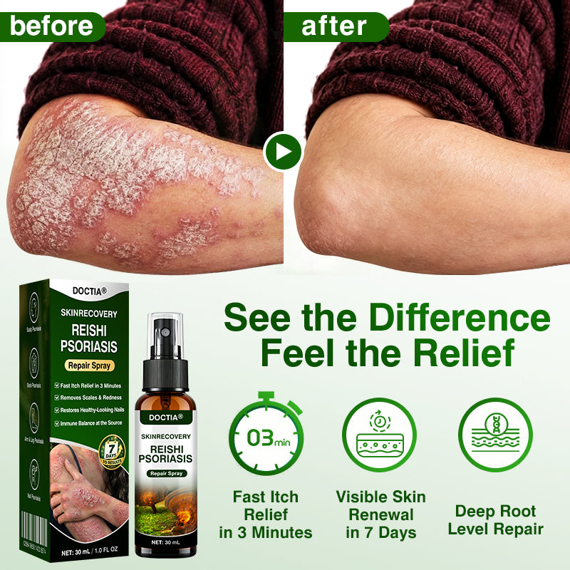🇺🇸🏅🛡️✅DOCTIA® SkinRecovery Reishi Psoriasis Repair Spray