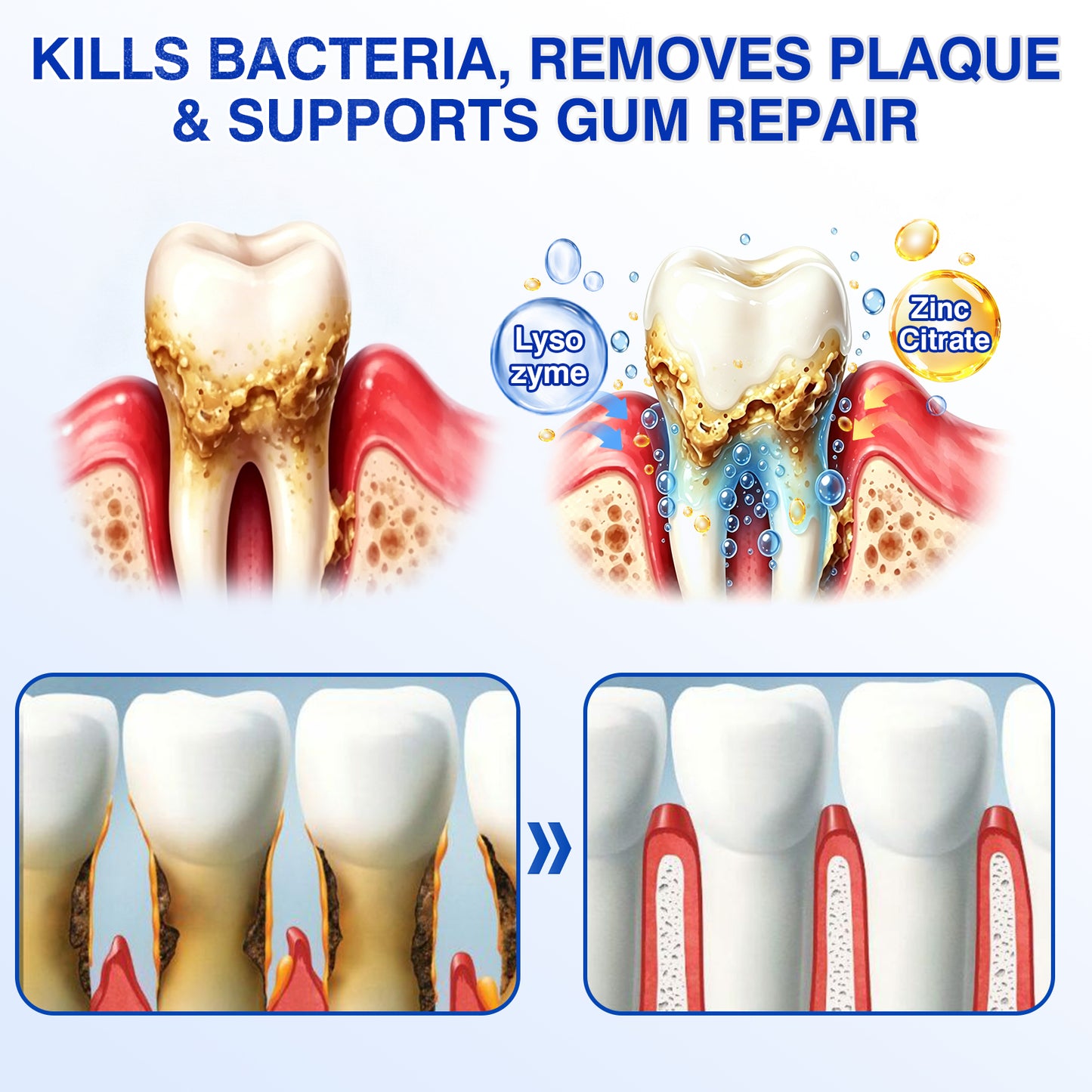 Evolvion® GumRevive Periodontal Repair Gel