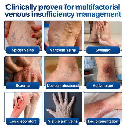 🇺🇸🎁GFOUK® VeinRenew Microneedle Balm