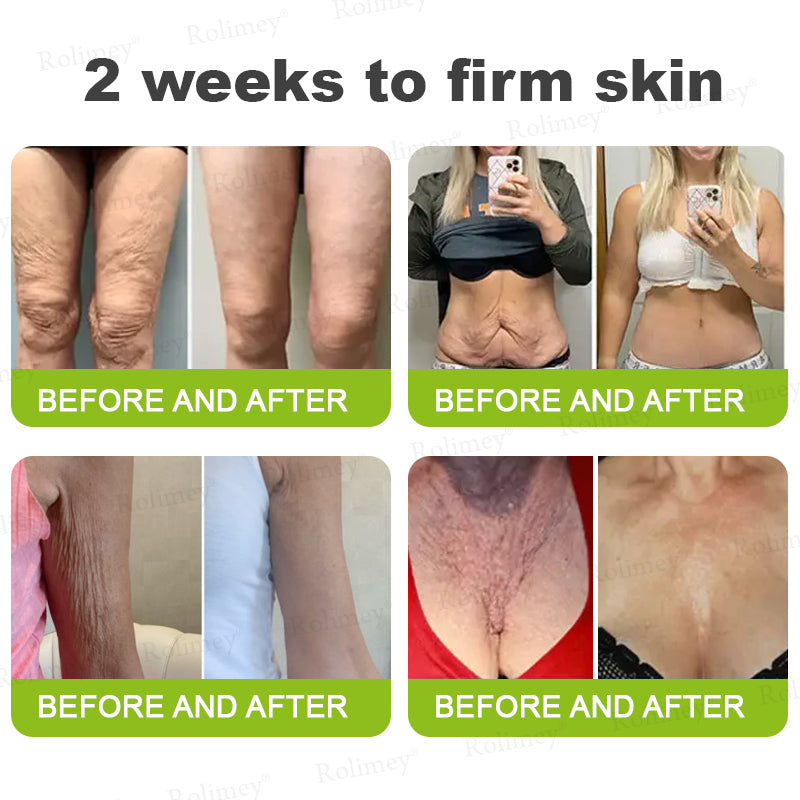 👏✨💯Made and shipped from the USA 💫Rolimey® Botox & Vita-A Retinol Shot Wrinkle-Lift Tightening cream - Last Day Promotion 70% OFF