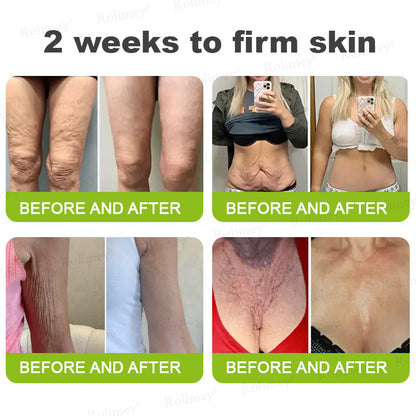 👏✨💯Made and shipped from the USA 💫Rolimey® Botox & Vita-A Retinol Shot Wrinkle-Lift Tightening cream - Last Day Promotion 70% OFF