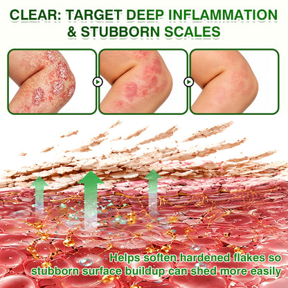 🇺🇸🏅🛡️✅DOCTIA® SkinRecovery Reishi Psoriasis Repair Spray