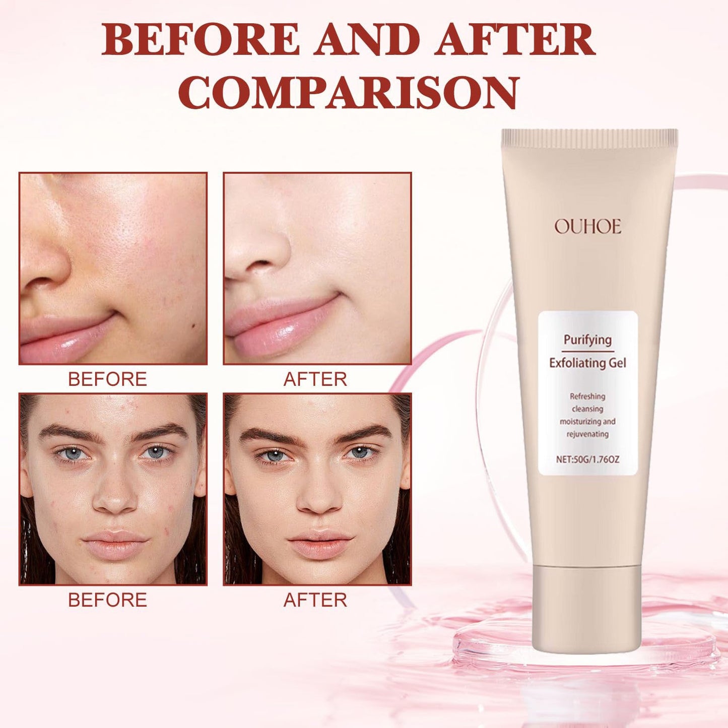 Purifying Enzymes Exfoliating Gel 50g(For All Skin Types)