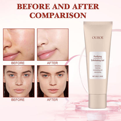 Purifying Enzymes Exfoliating Gel 50g(For All Skin Types)