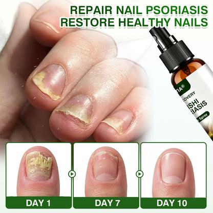 🇺🇸🏅🛡️✅DOCTIA® SkinRecovery Reishi Psoriasis Repair Spray