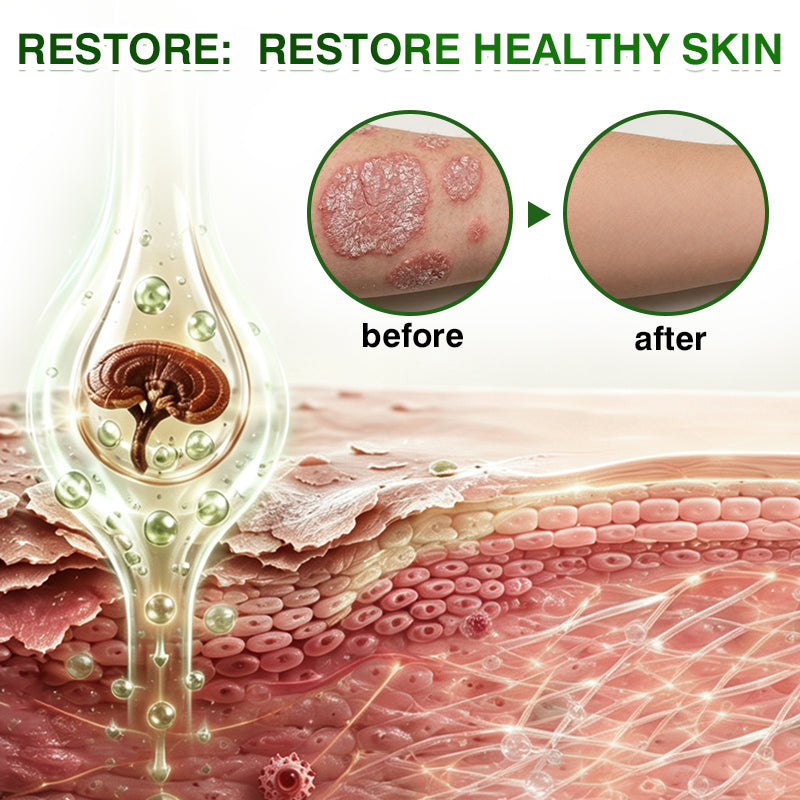 🇺🇸🏅🛡️✅DOCTIA® SkinRecovery Reishi Psoriasis Repair Spray