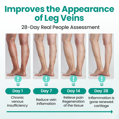 FDA-Approved👨‍⚕️✅🌿GFOUK® LegRenew Varicose Veins Patch(⚡Instant Relief, Long-Term Results)