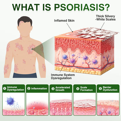 🇺🇸🏅🛡️✅DOCTIA® SkinRecovery Reishi Psoriasis Repair Spray
