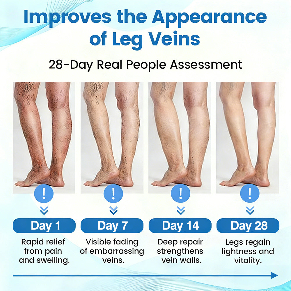 🇺🇸🎁GFOUK® VascuCare Vein Healing Spray(Designed for Varicose veins, Spider veins, Deep vein Thrombosis, Chronic venous insufficiency, Venous ulcers, Thrombophlebitis and other venous issues)
