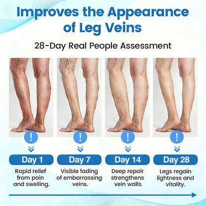 🇺🇸🎁GFOUK® VascuCare Vein Healing Spray(Designed for Varicose veins, Spider veins, Deep vein Thrombosis, Chronic venous insufficiency, Venous ulcers, Thrombophlebitis and other venous issues)