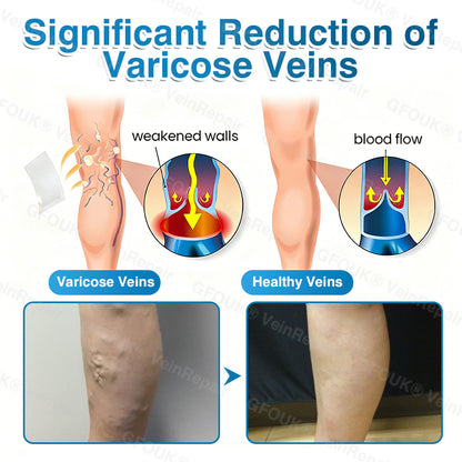 🇺🇸✅GFOUK® VeinRepair Microneedle Patch Roll⚡Instant Relief, Long-Term Results